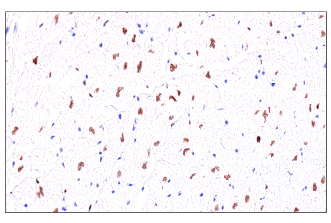 Immunohistochemistry Image 13: GATA-6 (D61E4) Rabbit Monoclonal Antibody (BSA and Azide Free)