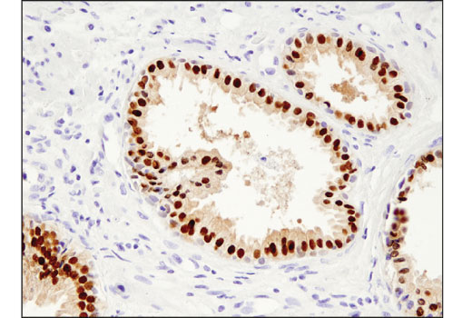 Immunohistochemistry Image 1: NKX3.1 (D6D2Z) Rabbit Monoclonal Antibody (BSA and Azide Free)