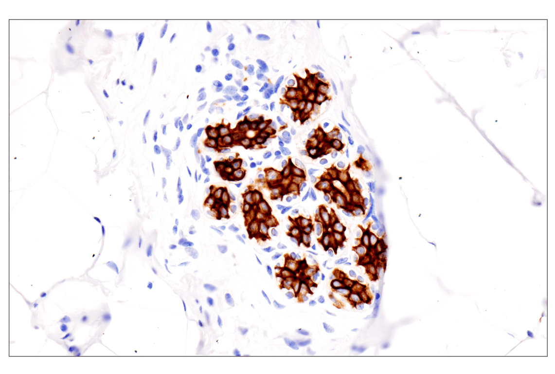 Immunohistochemistry Image 9: Pan-Keratin (Type II) (F6G1P) Rabbit Monoclonal Antibody