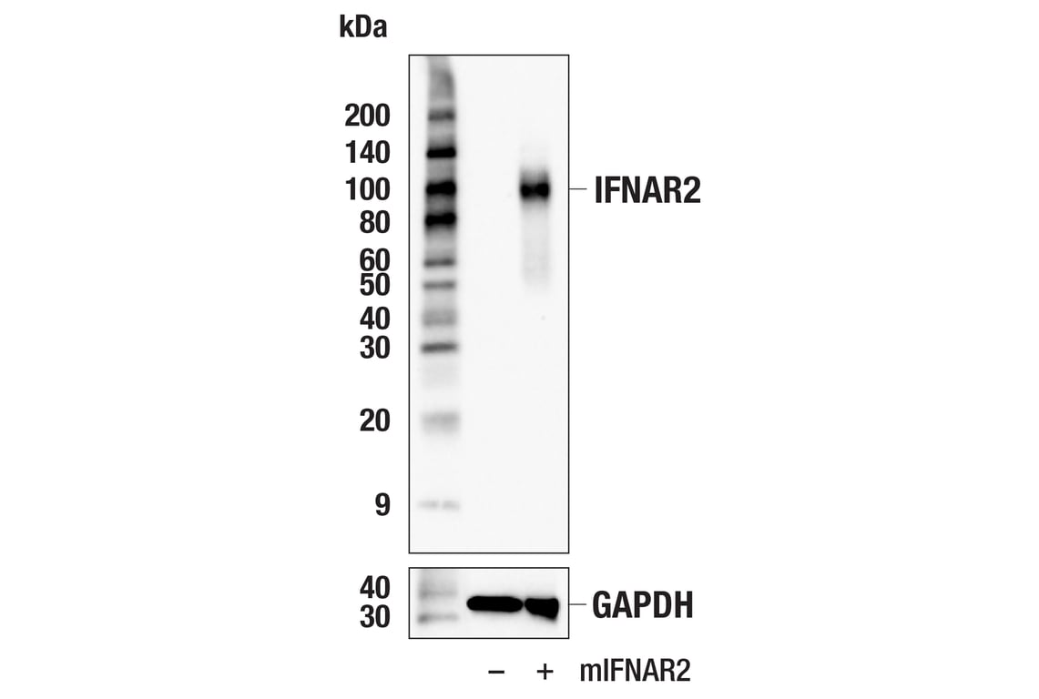 Western Blotting Image 3: IFNAR2 (E7R3A) Rabbit Monoclonal Antibody