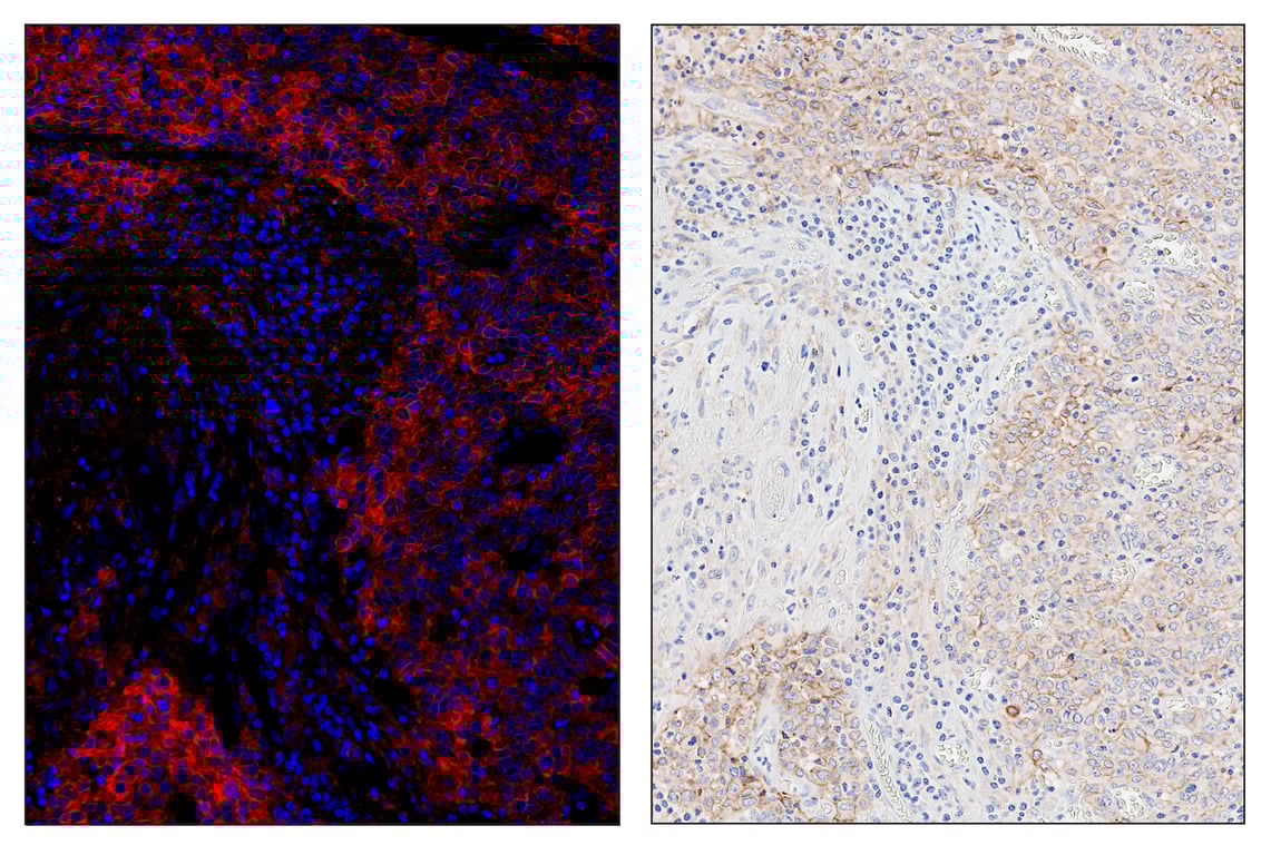 Immunohistochemistry Image 5: PD-L1 (E1L3N<sup>®</sup>) & CO-0005-594 SignalStar<sup>™</sup> Oligo-Antibody Pair