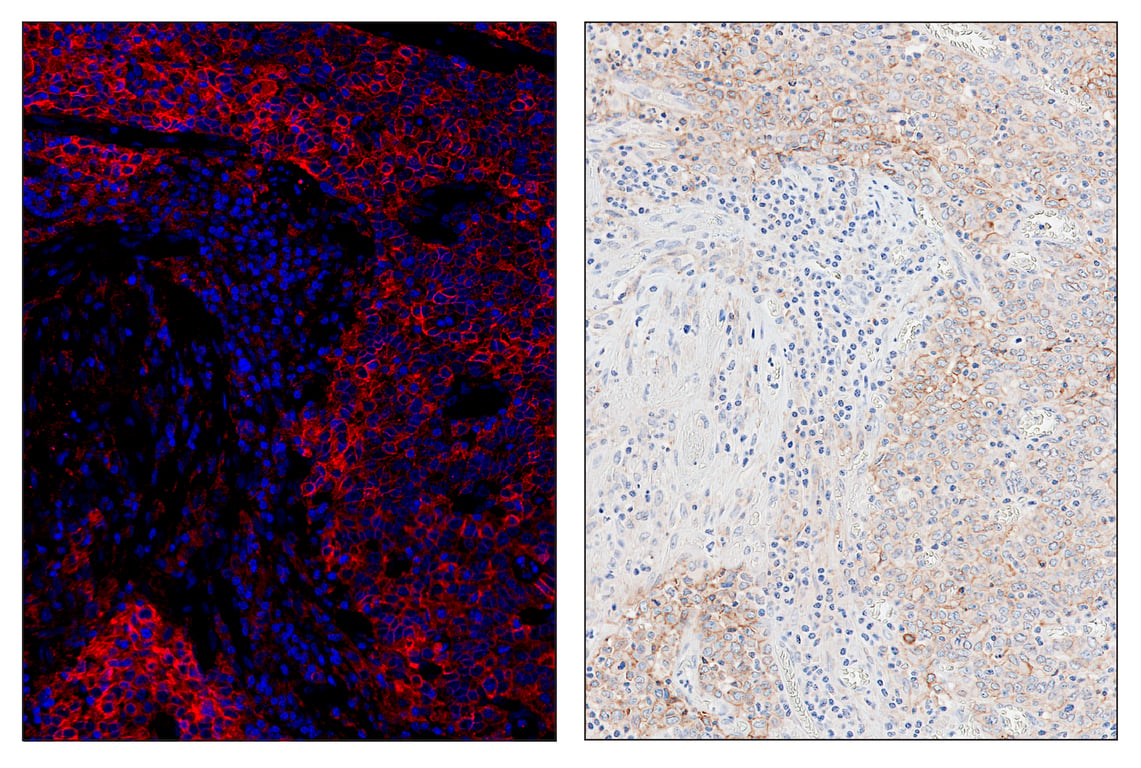 Immunohistochemistry Image 5: PD-L1 (E1L3N<sup>®</sup>) & CO-0005-647 SignalStar<sup>™</sup> Oligo-Antibody Pair