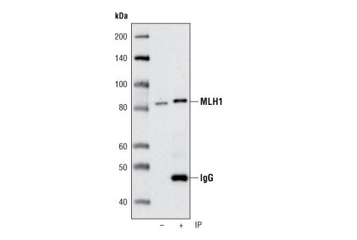 undefined Image 9: Mismatch DNA Repair (MMR) Antibody Sampler Kit