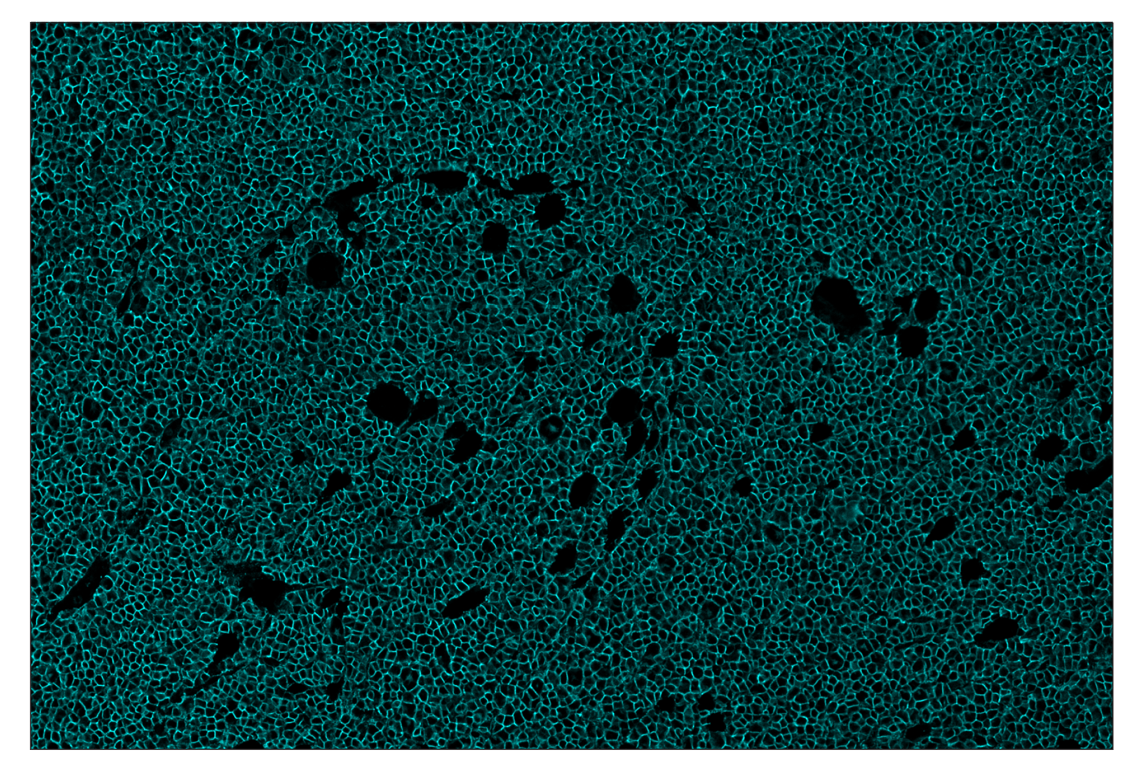 Immunohistochemistry Image 5: CD20 (E3N7O) & CO-0134-594 SignalStar<sup>™</sup> Oligo-Antibody Pair