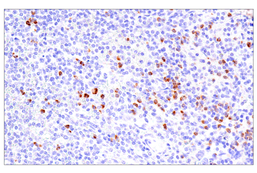 Immunohistochemistry Image 3: CEACAM6 (E7S7Y) Rabbit Monoclonal Antibody (BSA and Azide Free)