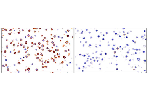 Immunohistochemistry Image 3: RIP3 (E7A7F) Rabbit Monoclonal Antibody