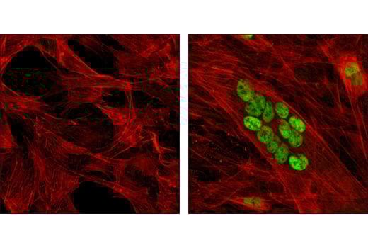 Immunofluorescence Image 1: MEF2C (D80C1) Rabbit Monoclonal Antibody