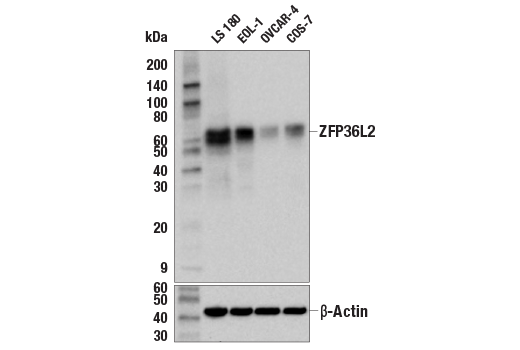 Western Blotting Image 2: ZFP36L2 (E4M9Z) Rabbit Monoclonal Antibody