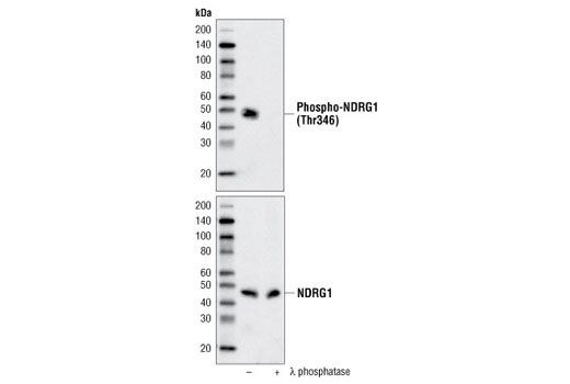 Western Blotting Image 3: Phospho-NDRG1 (Thr346) (D98G11) Rabbit Monoclonal Antibody (BSA and Azide Free)