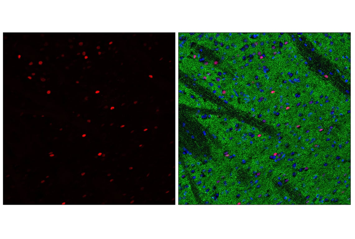 Immunofluorescence Image 1: c-Fos (E2I7R) Rabbit Monoclonal Antibody (BSA and Azide Free)