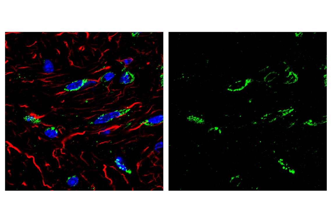 Immunofluorescence Image 1: Smac/Diablo (D5S3R) Rabbit Monoclonal Antibody