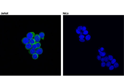 Immunofluorescence Image 1: SLP-76 (D1R1A) Rabbit Monoclonal Antibody