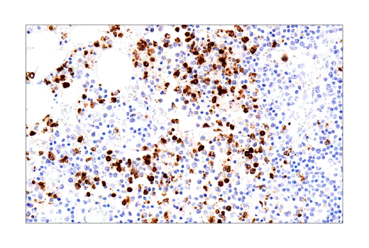 undefined Image 33: NETosis Antibody Sampler Kit