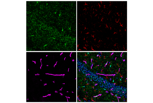 Immunofluorescence Image 4: CMTM6 (E6A8T) Rabbit Monoclonal Antibody
