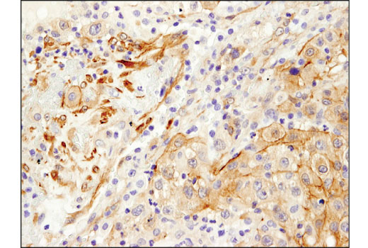 Immunohistochemistry Image 3: Palladin (D9H2) Rabbit Monoclonal Antibody