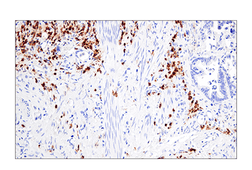 Immunohistochemistry Image 5: CRACC/SLAMF7/CD319 (E5C4M) Rabbit Monoclonal Antibody