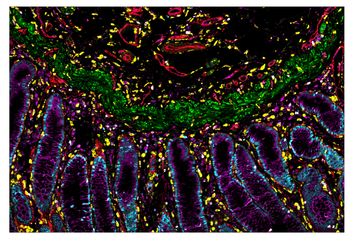 Immunohistochemistry Image 7: CD141/Thrombomodulin (E7Y9P) & CO-0088-594 SignalStar<sup>™</sup> Oligo-Antibody Pair