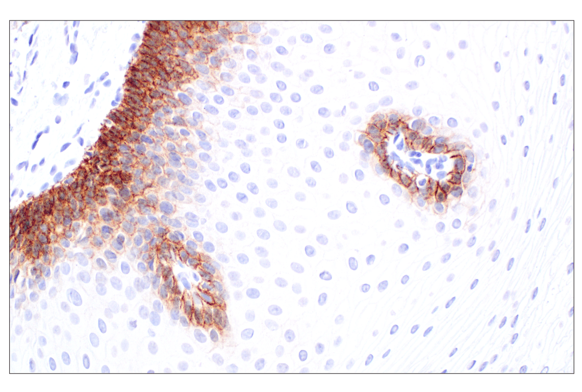 Immunohistochemistry Image 4: P-Cadherin (C13F9) Rabbit Monoclonal Antibody