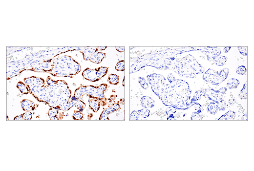 Immunohistochemistry Image 4: MAGE-A10 (E9V2Q) Rabbit Monoclonal Antibody (BSA and Azide Free)