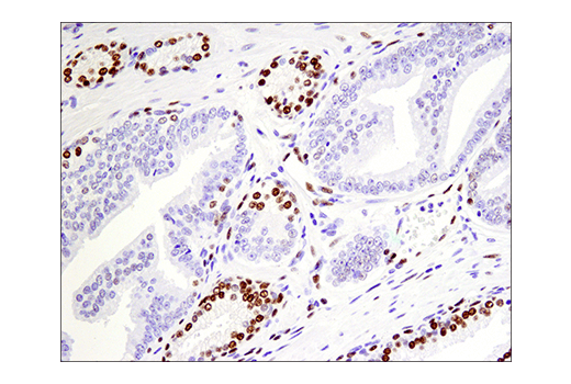 Immunohistochemistry Image 9: Phospho-ATF-2 (Thr71)/ATF-7 (Thr53) (E4A5G) Rabbit Monoclonal Antibody