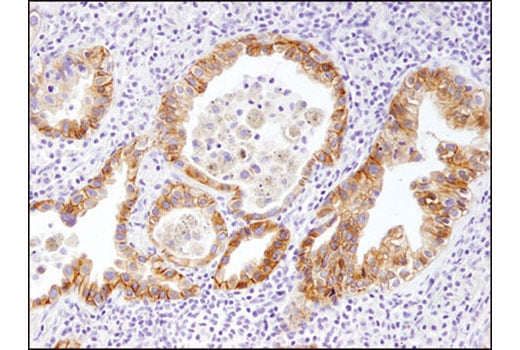 Immunohistochemistry Image 4: HER3/ErbB3 (D22C5) Rabbit Monoclonal Antibody (BSA and Azide Free)