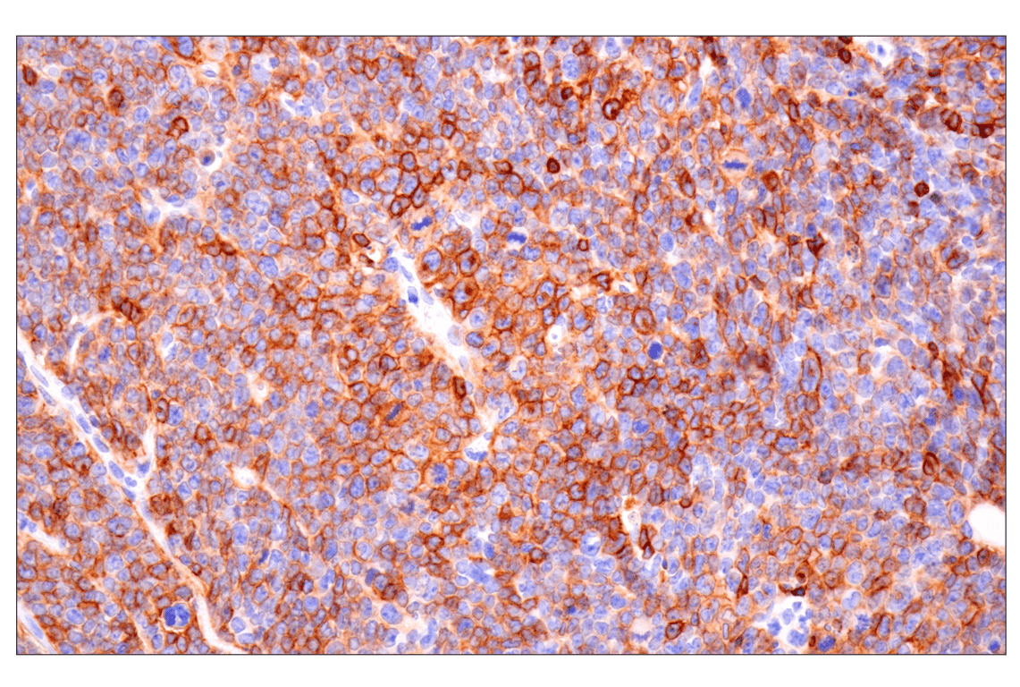 Immunohistochemistry Image 1: CD22 (F9D1W) Rabbit Monoclonal Antibody