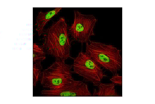 Immunofluorescence Image 1: Tri-Methyl-Histone H3 (Lys4) (C42D8) Rabbit Monoclonal Antibody (BSA and Azide Free)