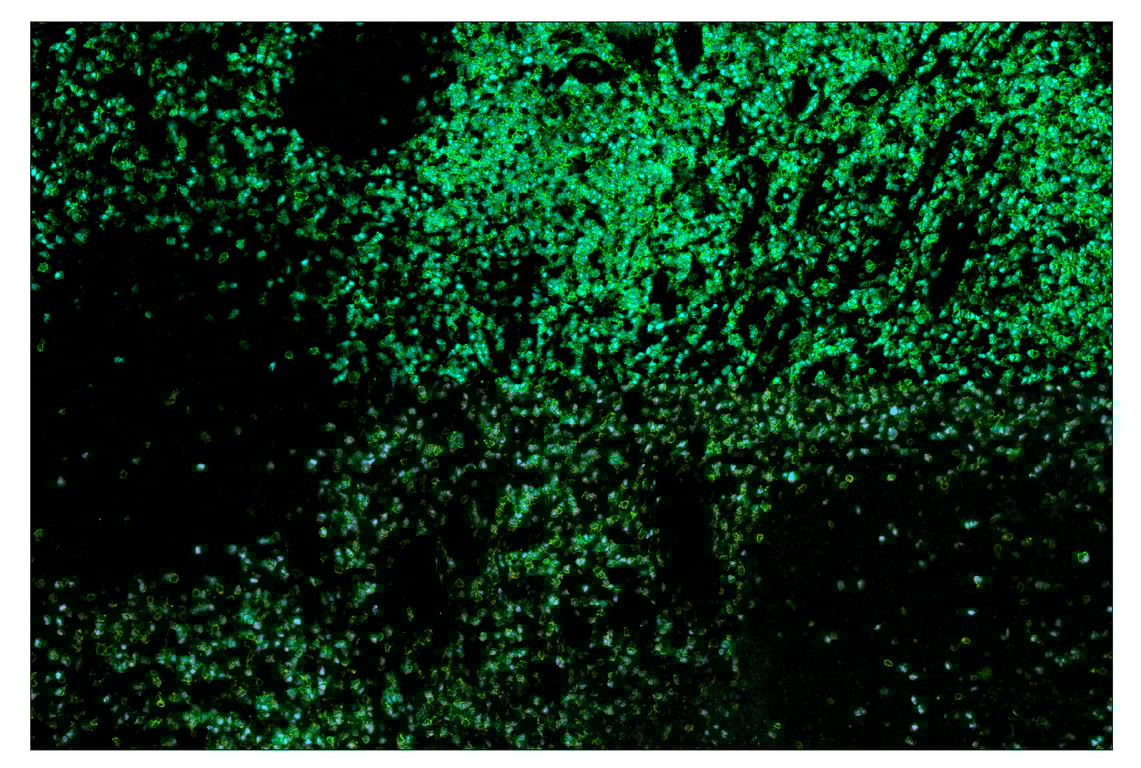 Immunohistochemistry Image 1: TCF1/TCF7 (C63D9) & CO-0006-594 SignalStar<sup>™</sup> Oligo-Antibody Pair