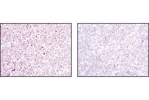 undefined Image 28: Human Reactive M1 vs M2 Macrophage IHC Antibody Sampler Kit