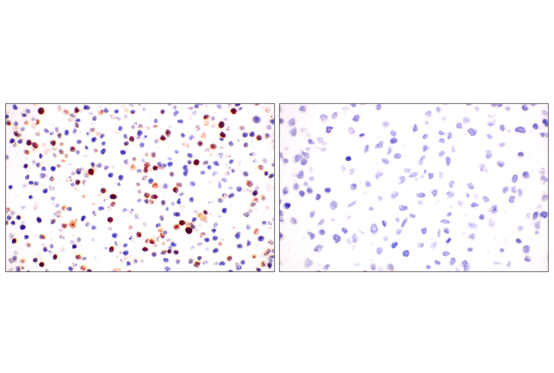 Immunohistochemistry Image 9: CD74 (F3R3L) Rabbit Monoclonal Antibody
