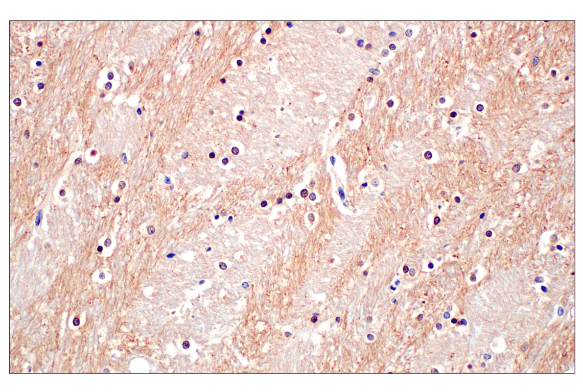 Immunohistochemistry Image 2: Phospho-Tau (Ser202) (F2A2F) Rabbit Monoclonal Antibody