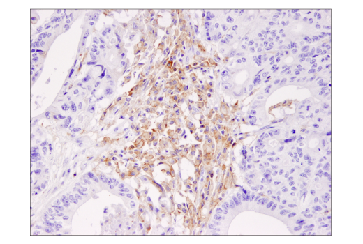 Immunohistochemistry Image 2: TIM-3 (D5D5R) Rabbit Monoclonal Antibody (BSA and Azide Free)