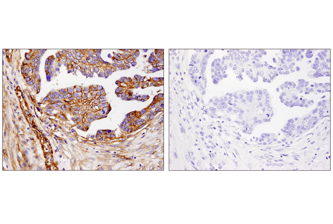 Immunohistochemistry Image 6: B7-H3 (D9M2L) Rabbit Monoclonal Antibody
