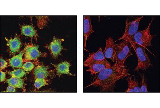 Immunofluorescence Image 1: Cool2/alpha Pix (C23D2) Rabbit Monoclonal Antibody