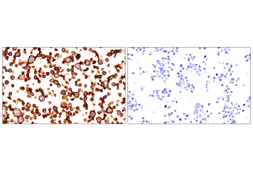 Immunohistochemistry Image 6: CD23 (E1R4G) Rabbit Monoclonal Antibody (BSA and Azide Free)