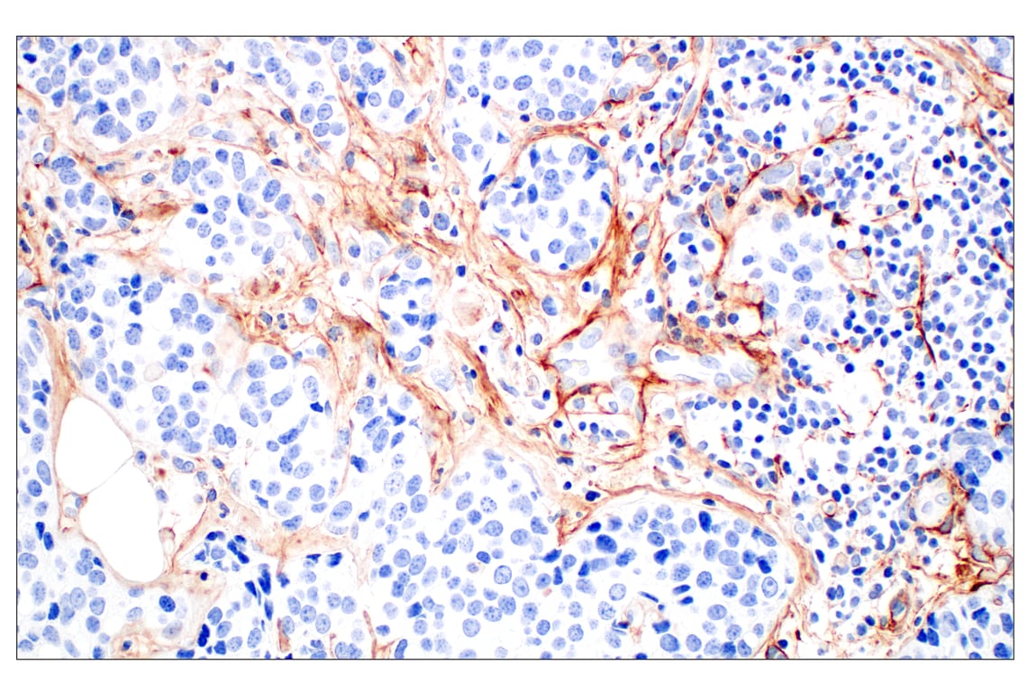 Immunohistochemistry Image 5: Tenascin C (E6N4L) Rabbit Monoclonal Antibody (BSA and Azide Free)