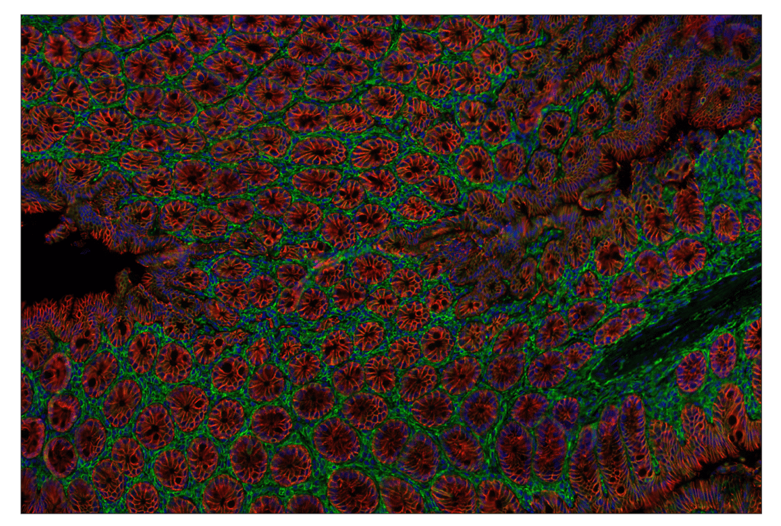 Immunohistochemistry Image 1: CD47 (E2V9V) & CO-0141-647 SignalStar<sup>™</sup> Oligo-Antibody Pair
