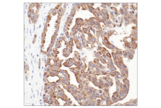 Immunohistochemistry Image 4: Pan-Keratin (C11) Mouse Monoclonal Antibody (BSA and Azide Free)