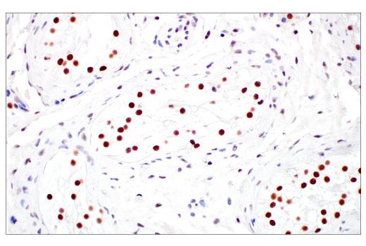 Immunohistochemistry Image 8: TIF1α/TRIM24 (E9T3N) Rabbit mAb