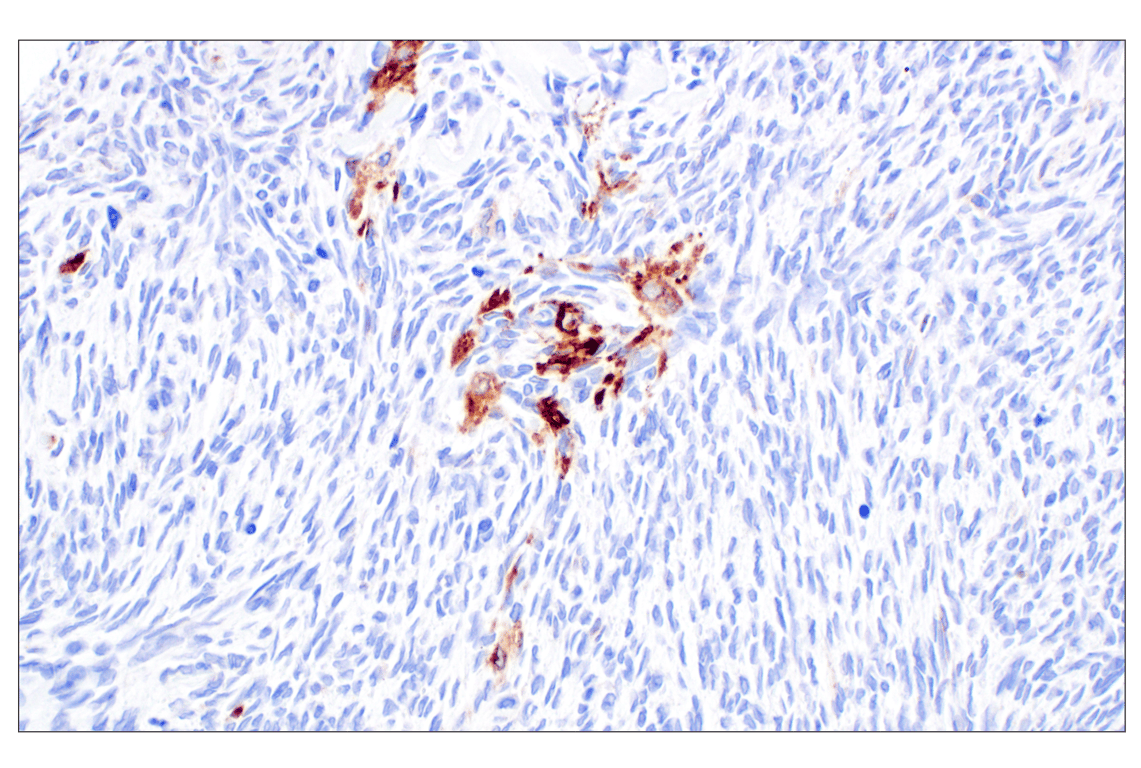 Immunohistochemistry Image 3: DLK1 (F7O3Q) Rabbit Monoclonal Antibody