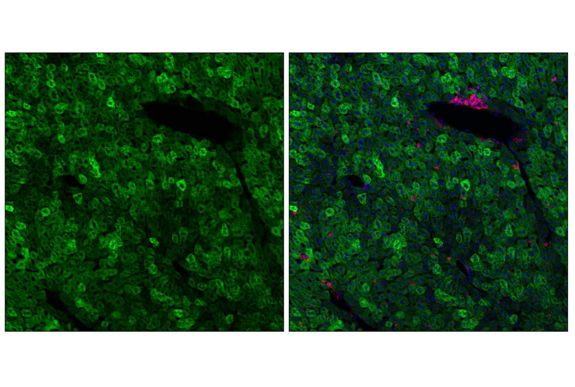 Immunofluorescence Image 2: SCD1 (C12H5) Rabbit Monoclonal Antibody (Alexa Fluor<sup>®</sup> 488 Conjugate)