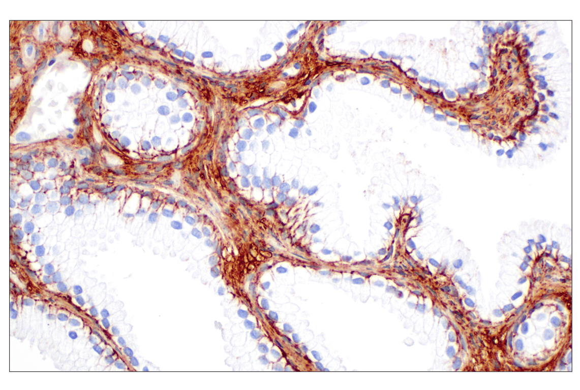 Immunohistochemistry Image 5: Hyaluronan Complete Tissue Staining Kit (HRP)