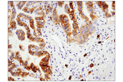 Immunohistochemistry Image 3: c-Kit (D3W6Y) Rabbit Monoclonal Antibody