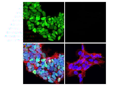 Immunofluorescence Image 1: HOXB9 (E7P5O) Rabbit Monoclonal Antibody