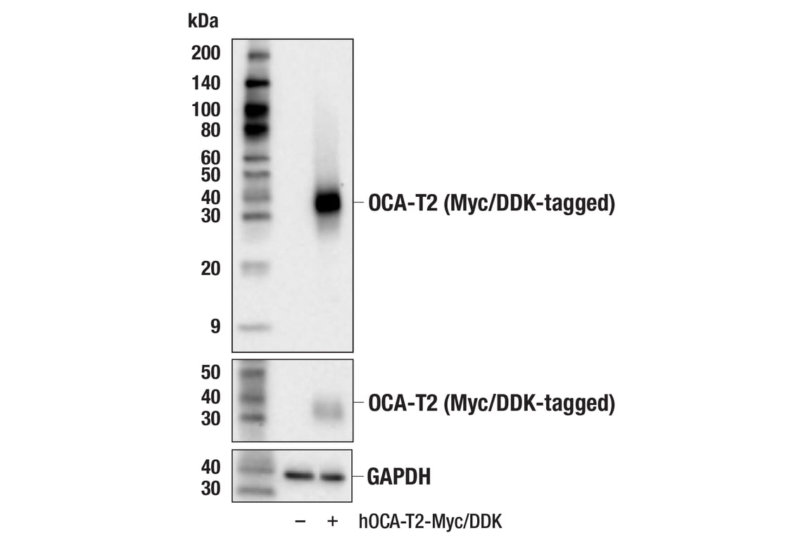 Western Blotting Image 2: OCA-T2 (F5A7Z) Rabbit Monoclonal Antibody