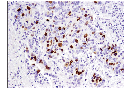Immunohistochemistry Image 1: FoxM1 (D3F2B) Rabbit Monoclonal Antibody