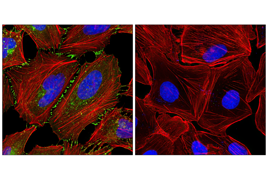 Immunofluorescence Image 1: beta-Catenin (L54E2) Mouse Monoclonal Antibody