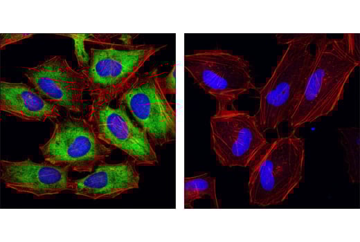 Immunofluorescence Image 1: Phospho-S6 Ribosomal Protein (Ser240/244) (D68F8) Rabbit Monoclonal Antibody (BSA and Azide Free)