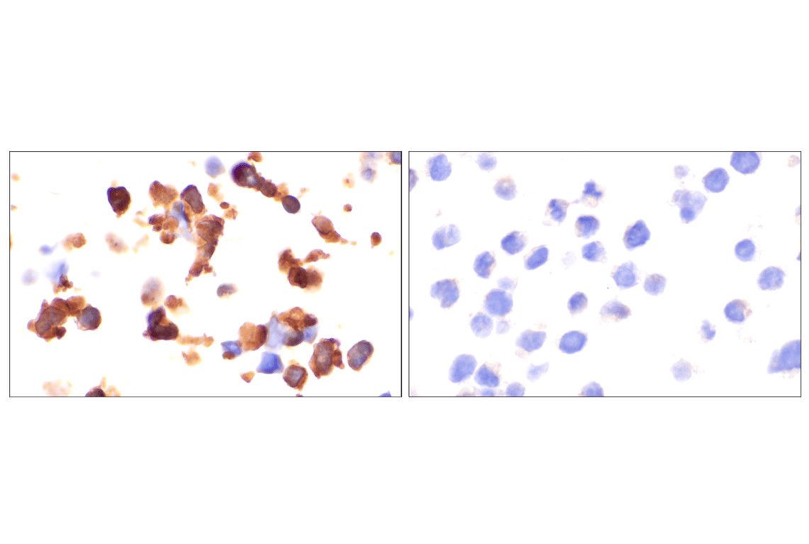 Immunohistochemistry Image 8: YAP (D8H1X) Rabbit Monoclonal Antibody