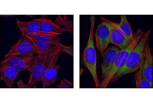 undefined Image 16: Translation Initiation Complex Antibody Sampler Kit